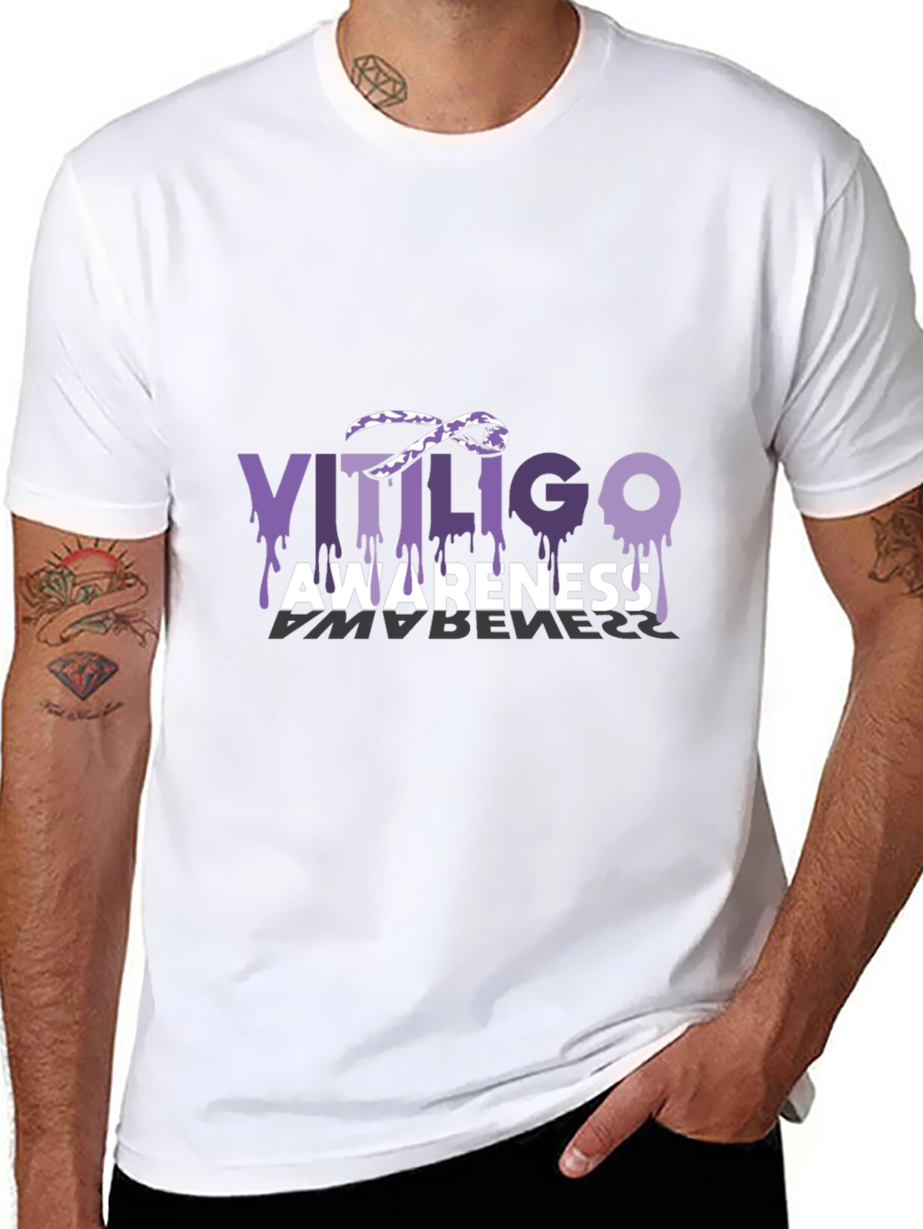 Vitiligo Awareness T-Shirt Purple Ribbon Melanocytes Gift
