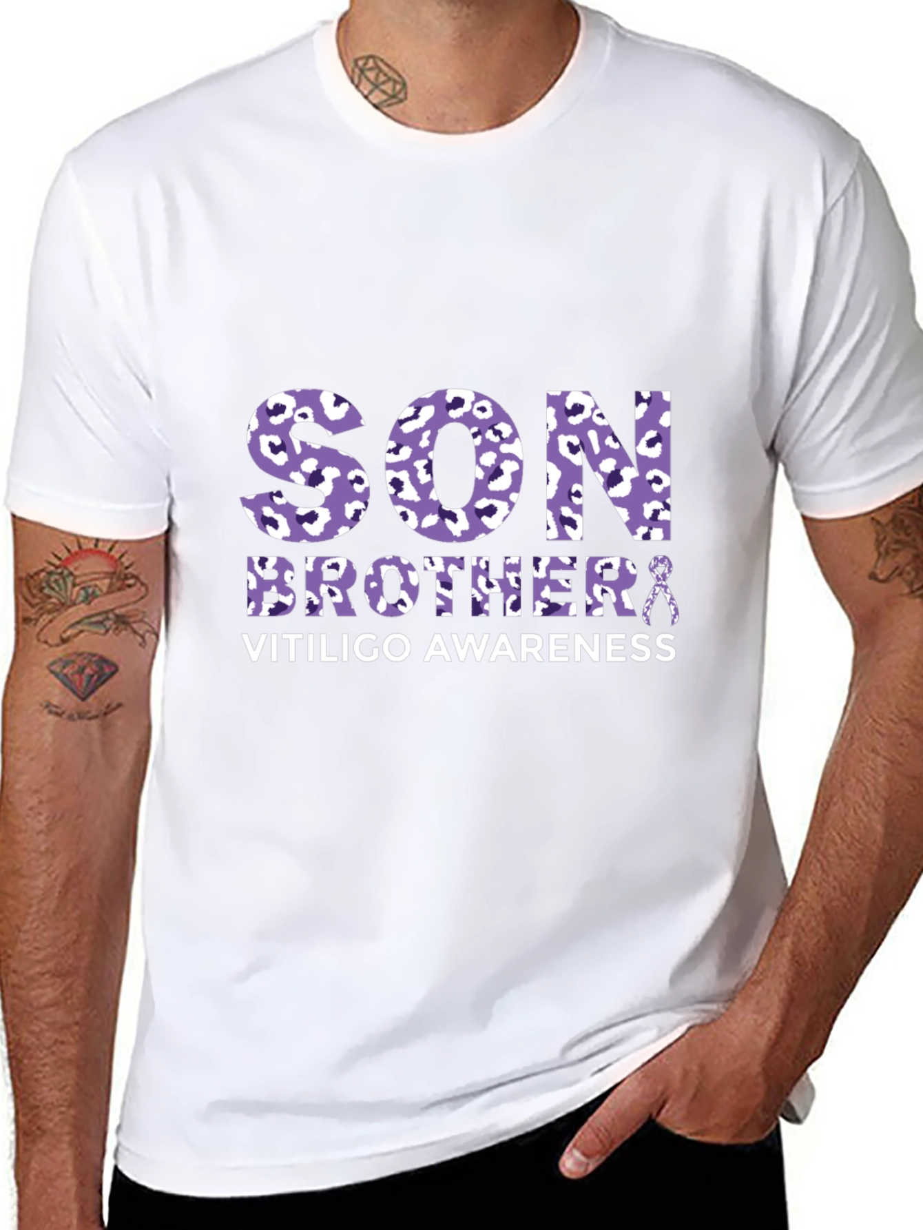 Vitiligo Awareness Son Brother T-Shirt
