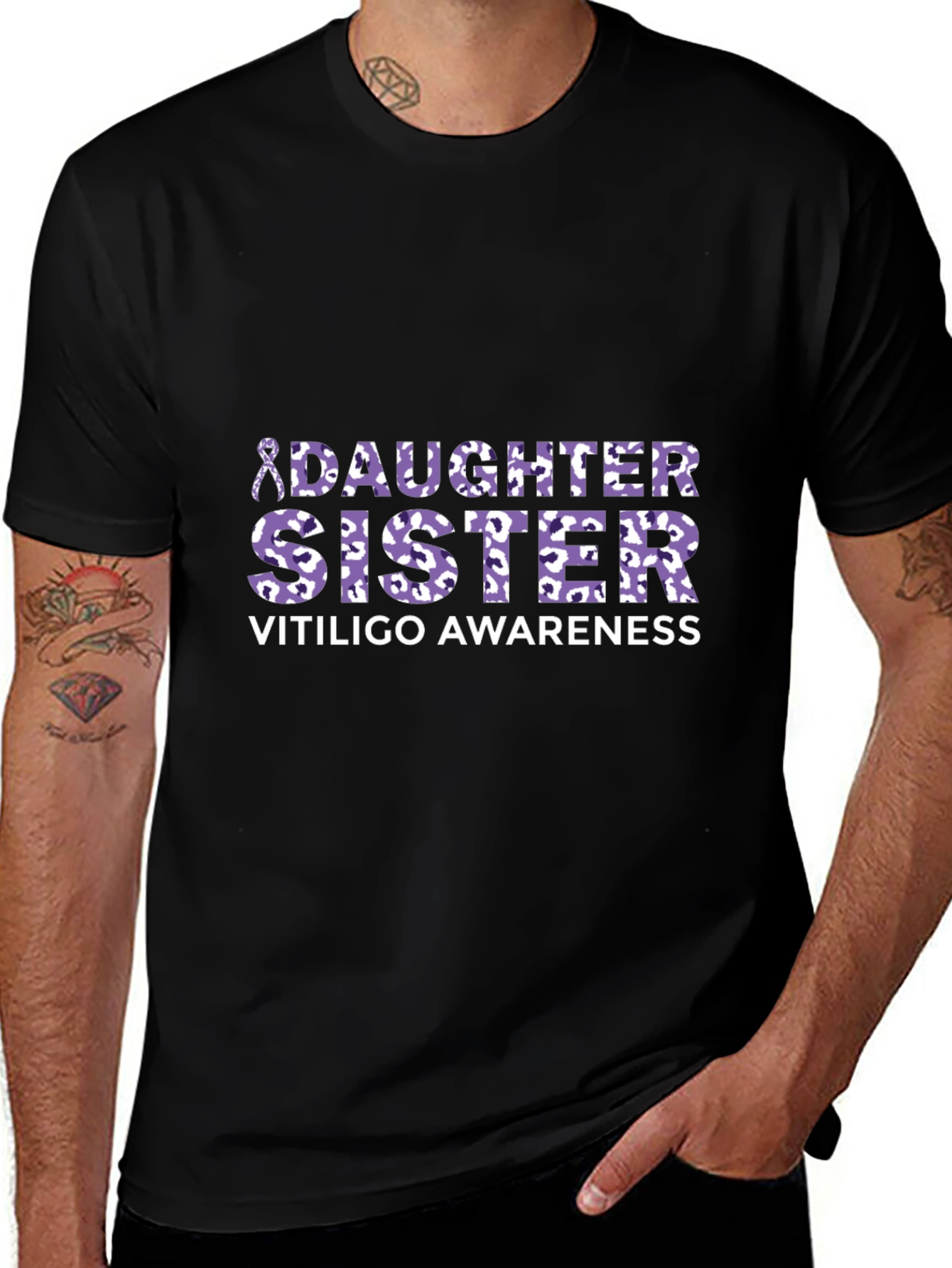 Vitiligo Awareness Daughter Sister T-Shirt