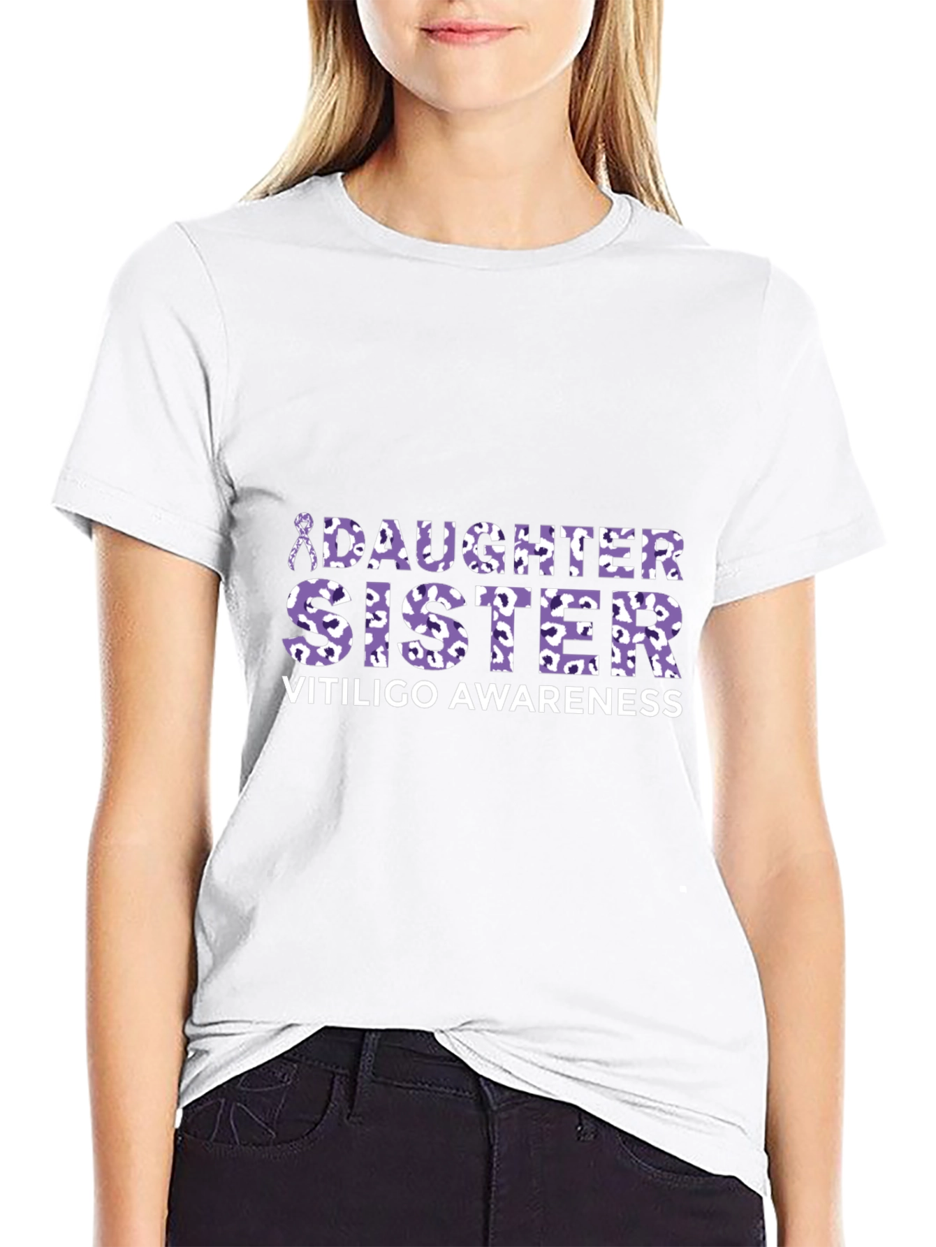 Vitiligo Awareness Daughter Sister T-Shirt