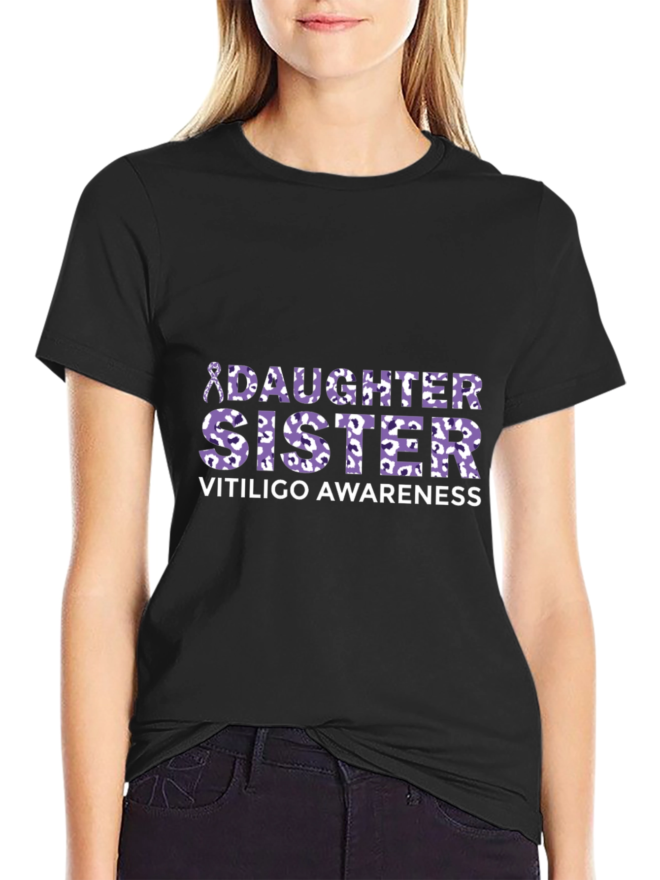 Vitiligo Awareness Daughter Sister T-Shirt