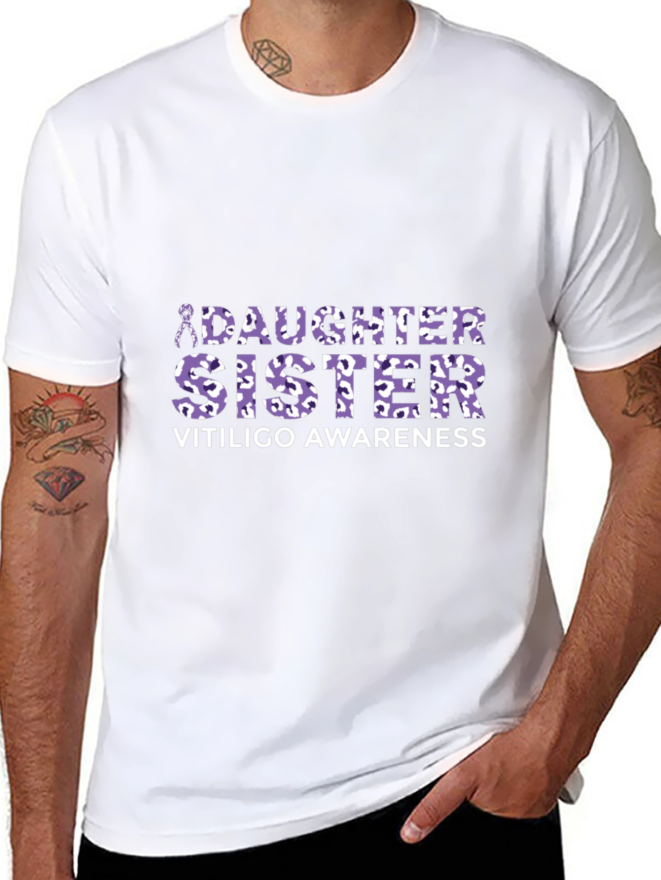 Vitiligo Awareness Daughter Sister T-Shirt