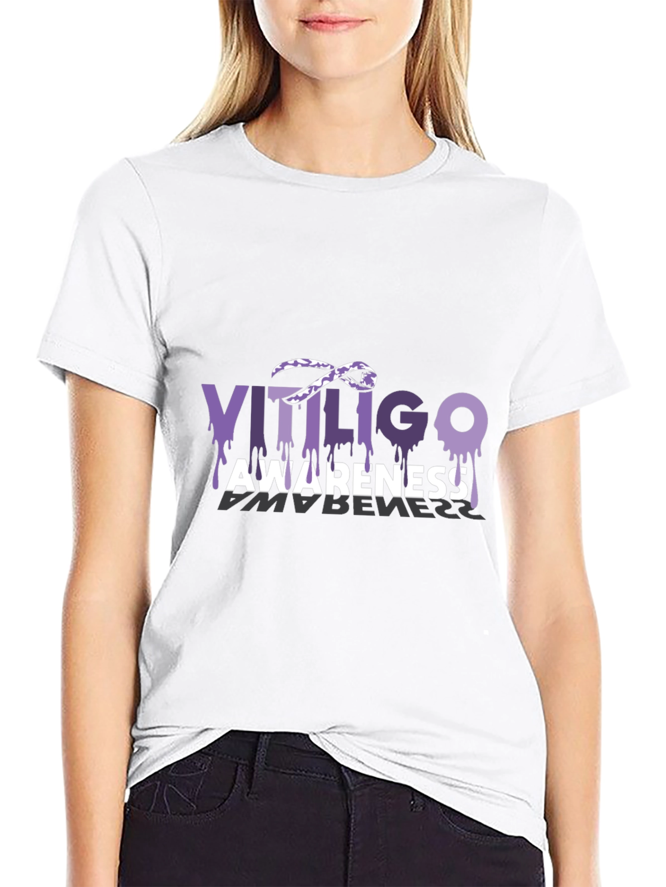 Vitiligo Awareness T-Shirt Purple Ribbon Melanocytes Gift