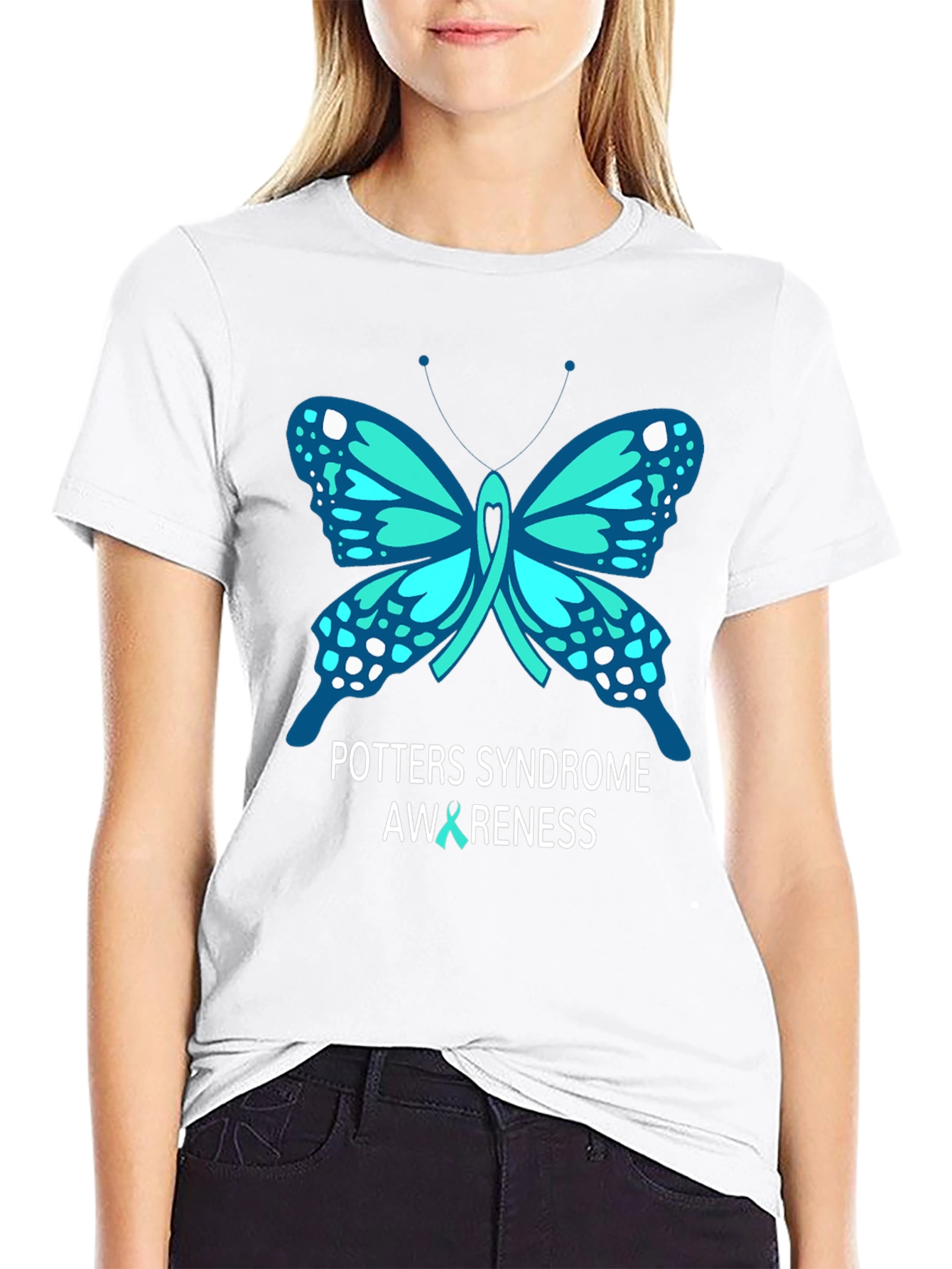 Potters Syndrome Awareness Butterfly T-Shirt