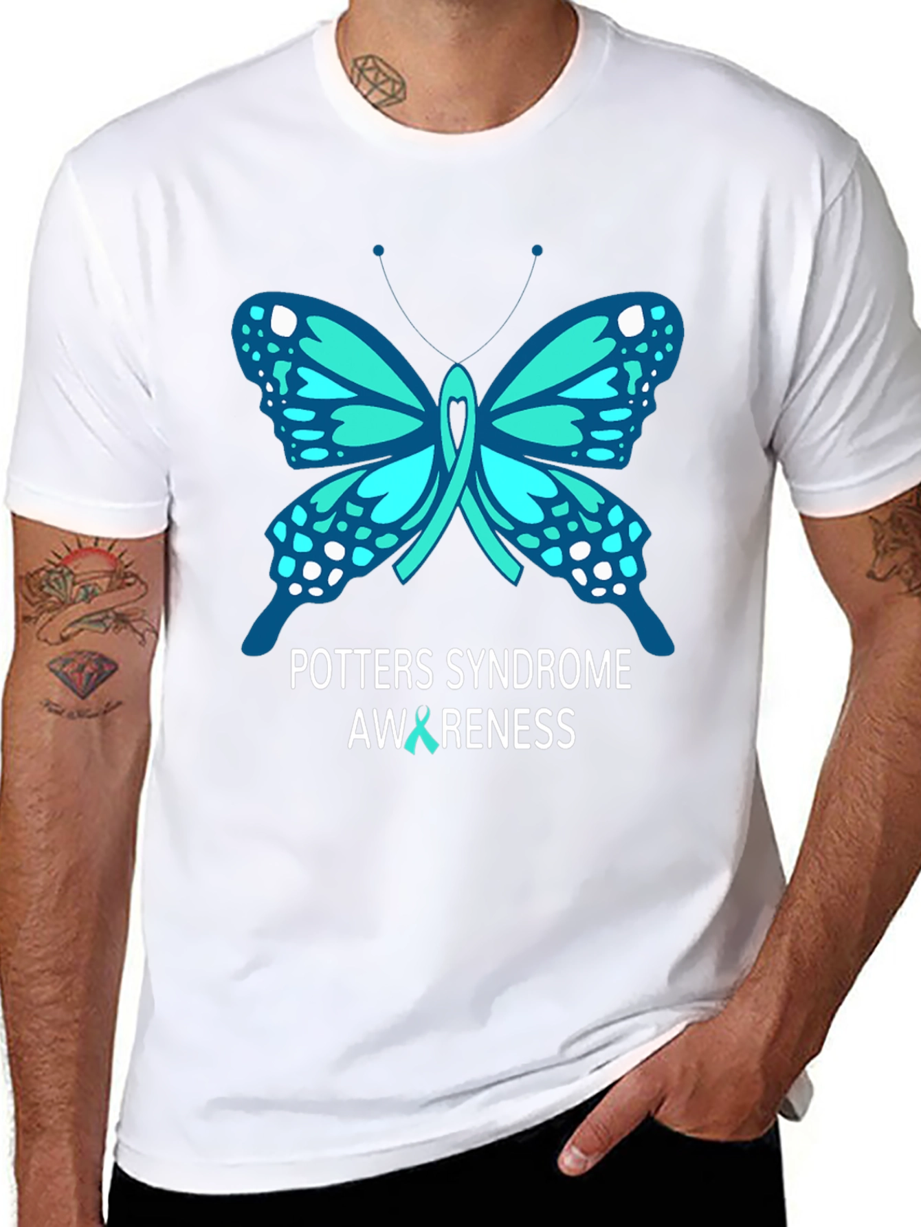 Potters Syndrome Awareness Butterfly T-Shirt